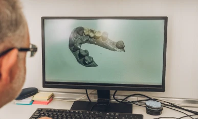 CAD software for dental design and planning at Smilerite Dental Care