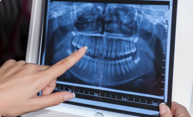 Sirona X digital X-ray system for dental imaging at Smilerite Dental Care